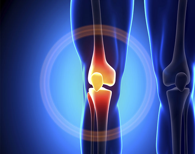 orthopedics-knee-joint-pain-relief-replacement/